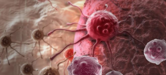 Признаки раковой интоксикации и ее лечение